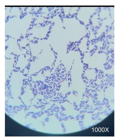Gram Positive Stain